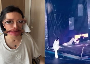 Sự cố sân khấu rơi màn hình led 600kg tại concert Mirror, Hồng Kông